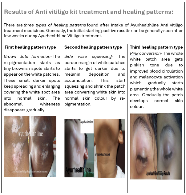vitiligo treatment in Ayurveda