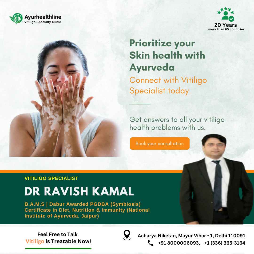 customized vitiligo treatment