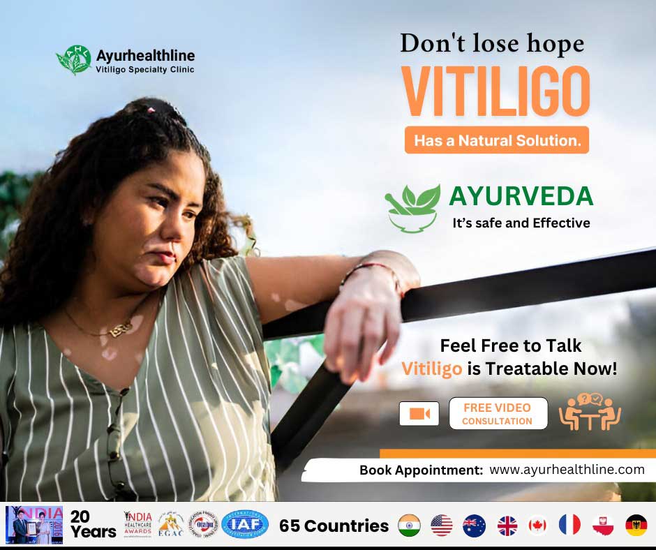 vitiligo cure treatment