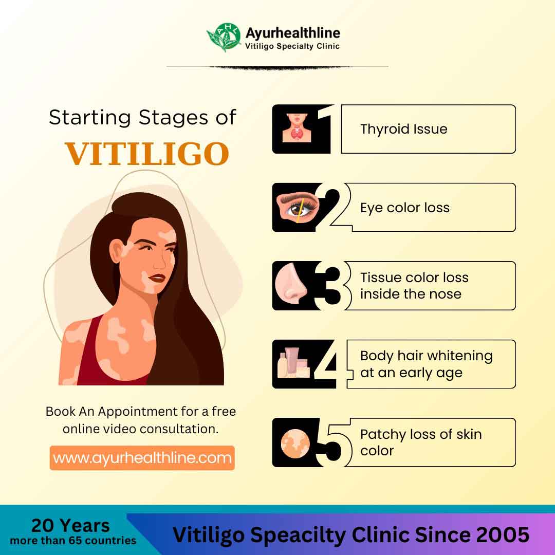 vitiligo
