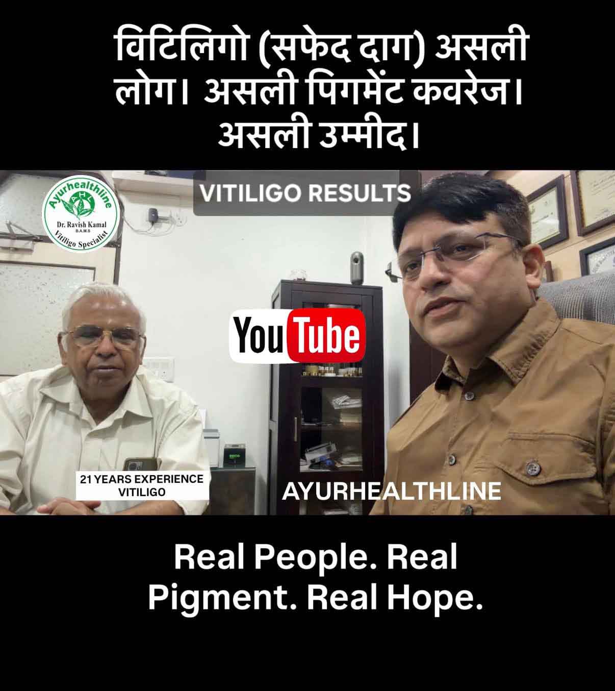 Vitiligo Specialty Results of patients, vitiligo specialist