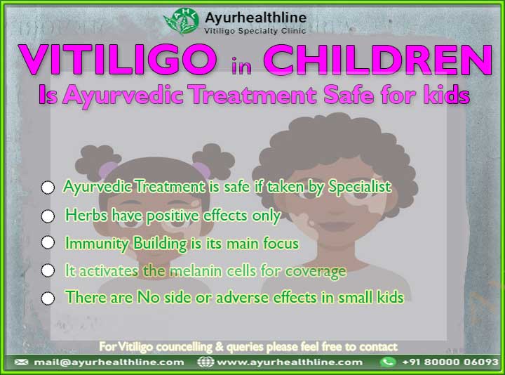 vitiligo in children, kid vitiligo treatment , vitiligo treatment for small kids